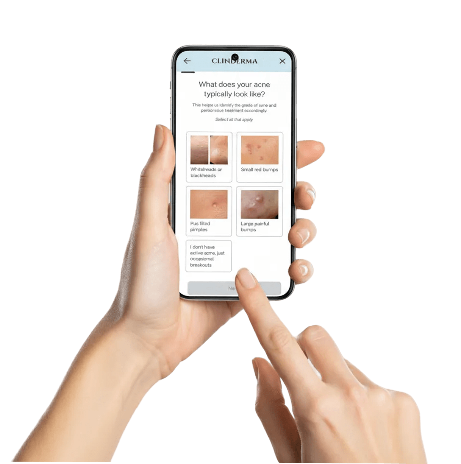 Take a skin test