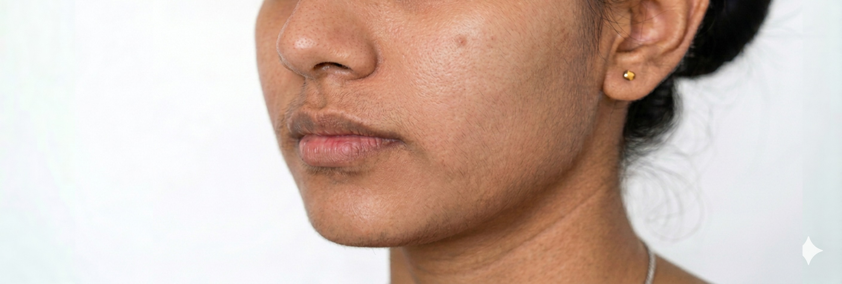 Visible result